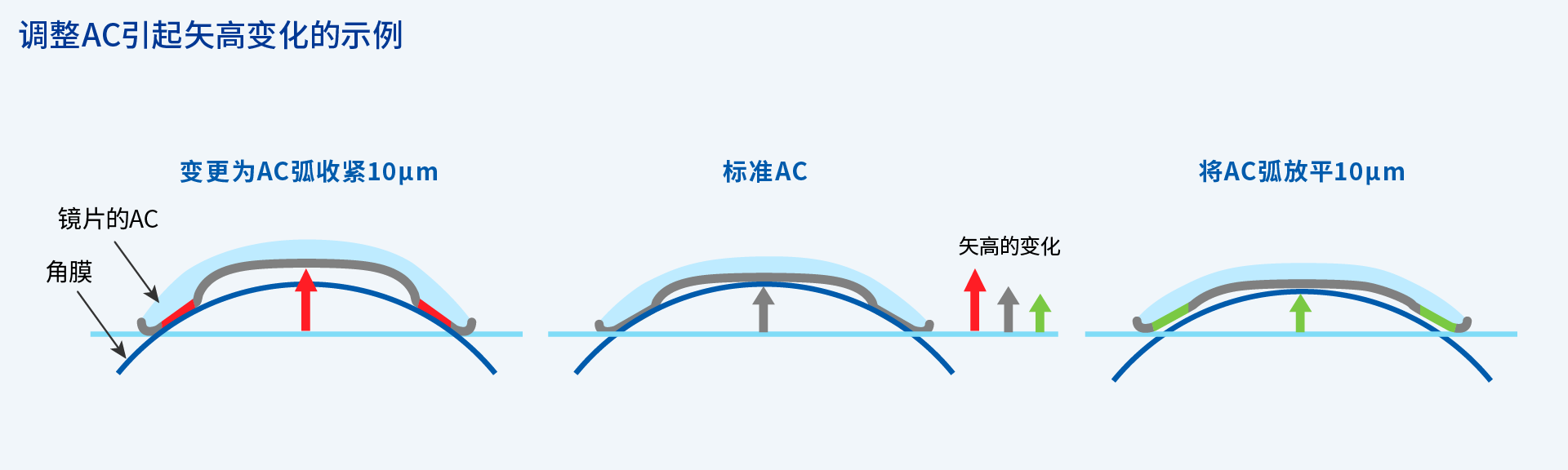 图：调整AC引起矢高变化的示例